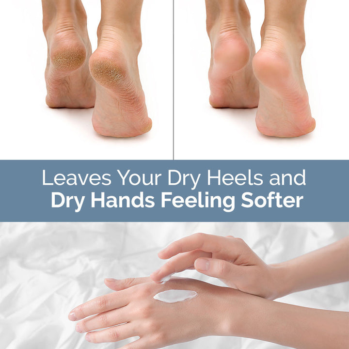 Hand and Foot Crack Repair Cream - 100g | WBM Care