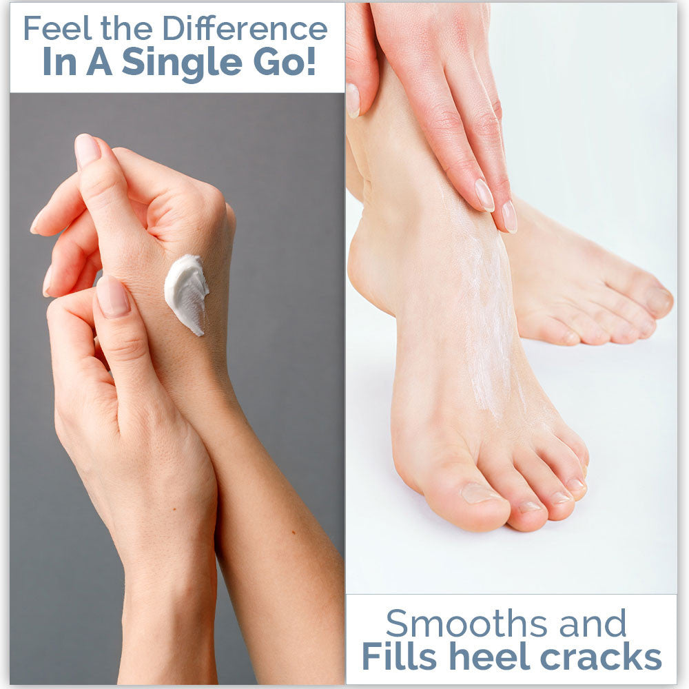 Hand and Foot Crack Repair Cream - 100g | WBM Care