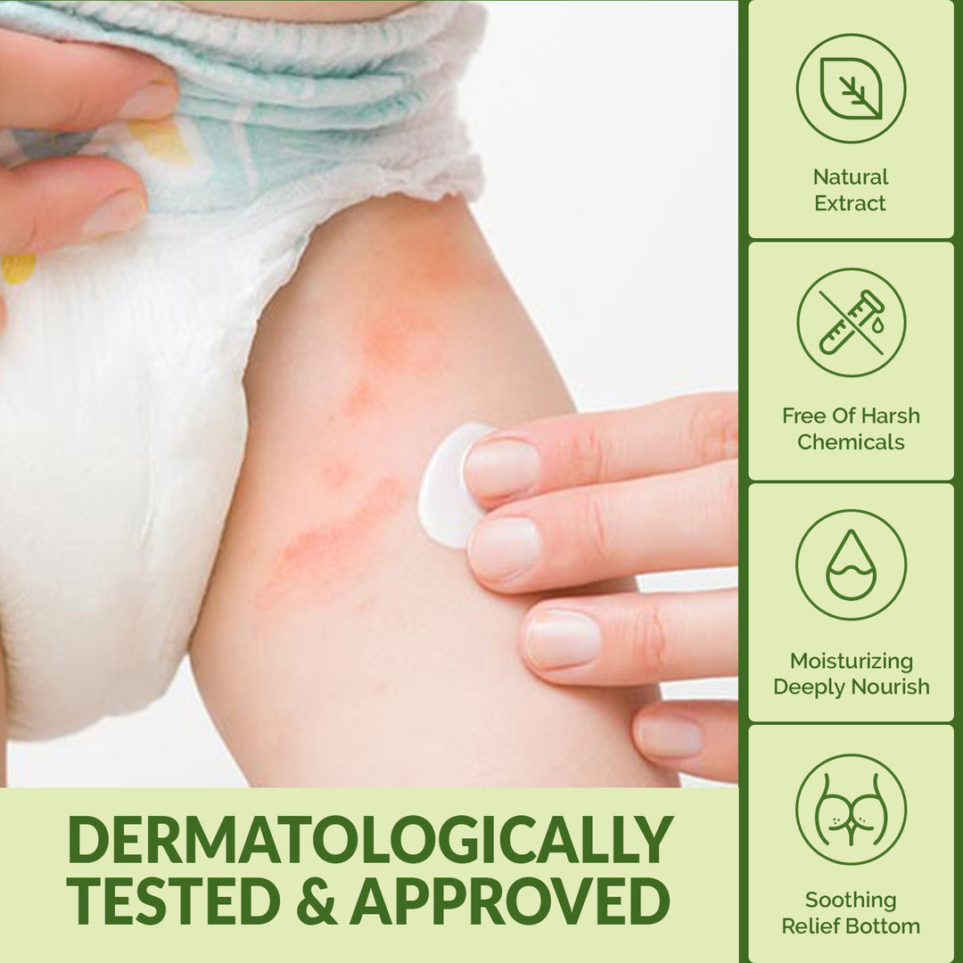 Baby Diaper Rash Cream - 80 g | WBM Baby Care