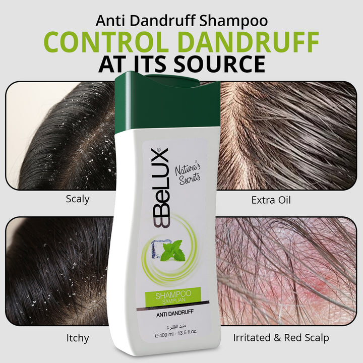 (Pack of 3) Anti Dandruff Shampoo - 400ml | WBM Belux