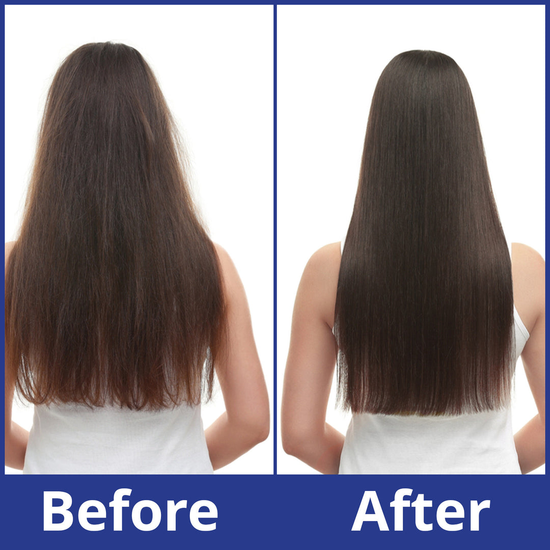 Pack of 3 | Anti Hair Loss Shampoo - 400ml | Belux