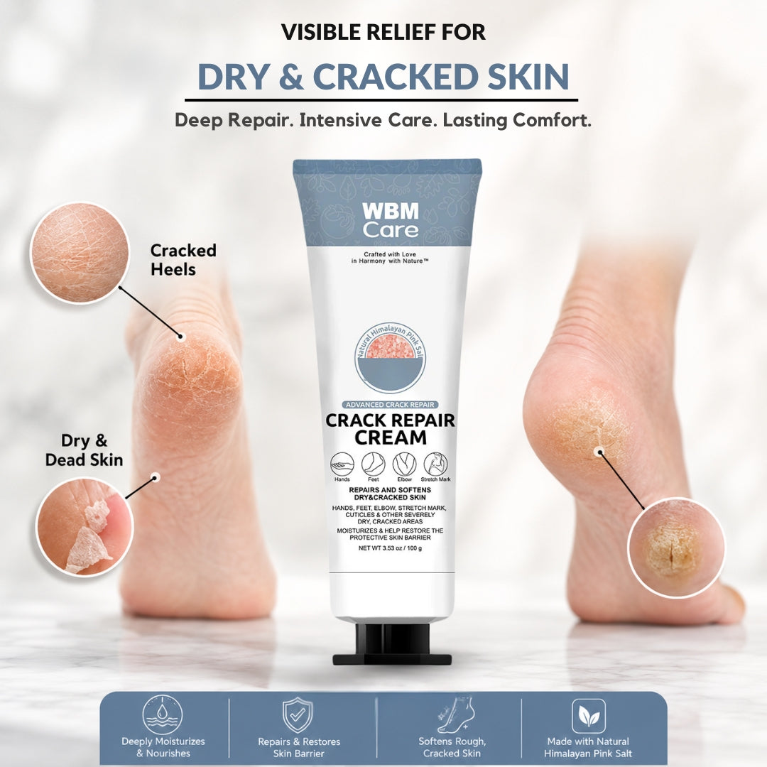 Hand and Foot Crack Repair Cream - 100g | WBM Care