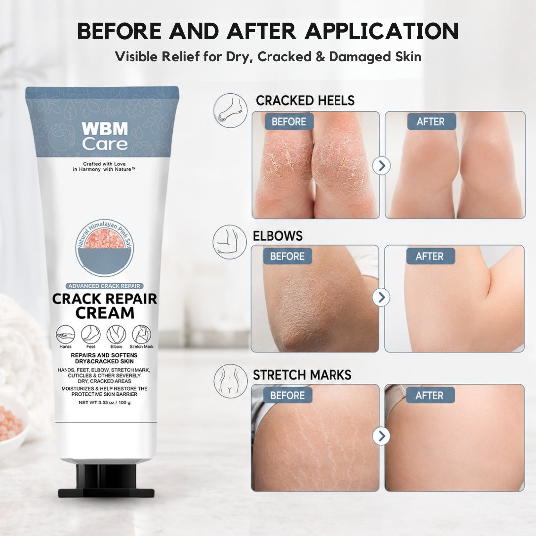 Hand and Foot Crack Repair Cream - 100g | WBM Care