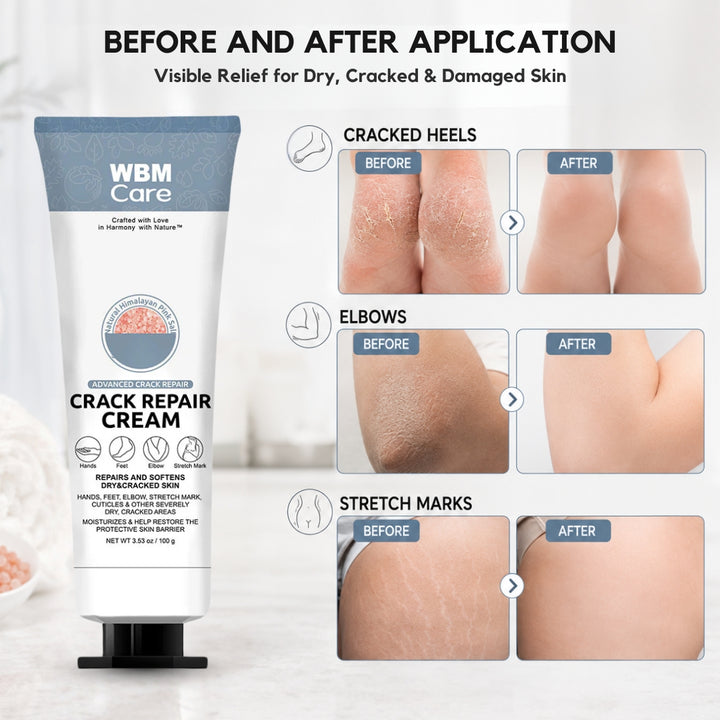 Hand and Foot Crack Repair Cream - 100g | WBM Care