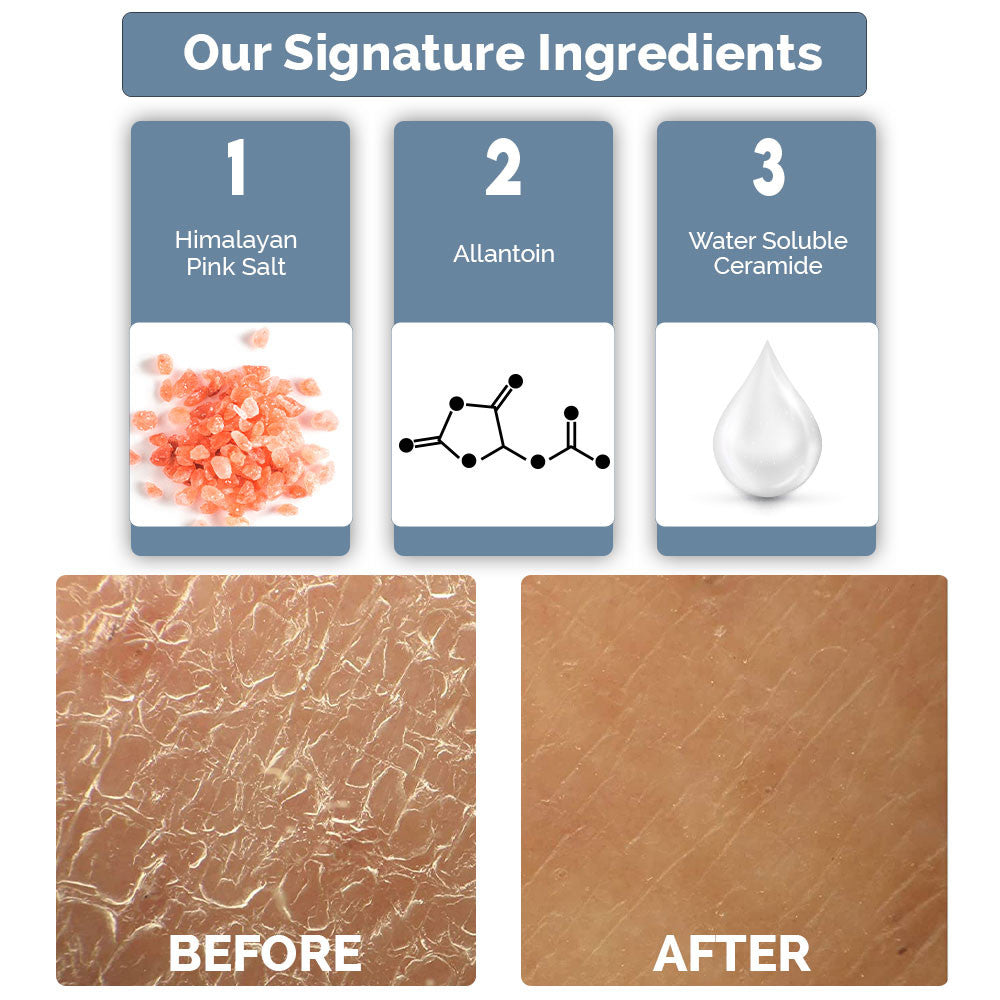 Hand and Foot Crack Repair Cream - 100g | WBM Care