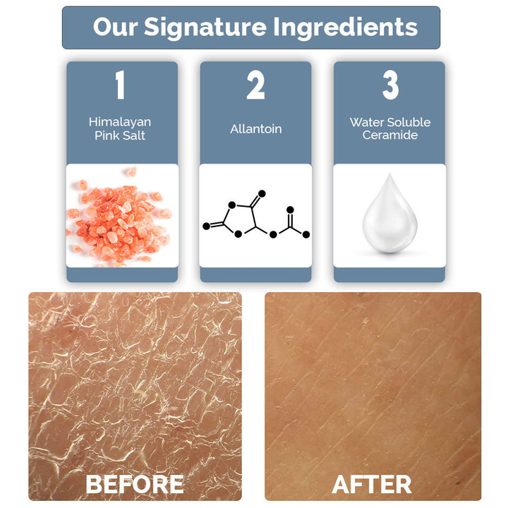 Hand and Foot Crack Repair Cream - 100g | WBM Care